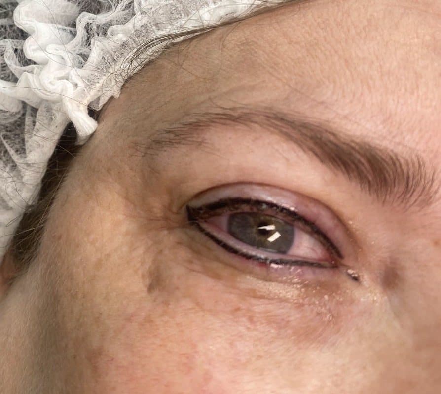Permanent eyeliner result, a clean defined line along the lash line